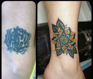Mandala Cover Up Tattoo Withe Leaves 300x257