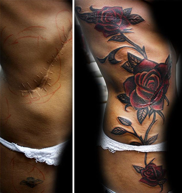 Scars Tattoos Cover Up 50